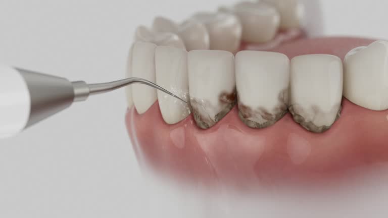 Reliable Dental Implants contractor in Three Rivers, TX by Smile Center Dentistry